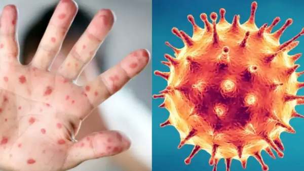 ஜெர்மனி 