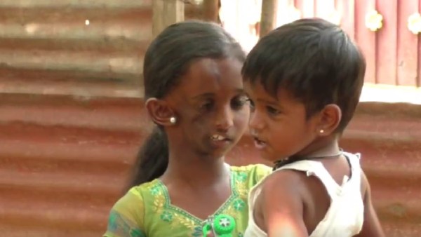 சாதாரண ரத்த கட்டு 