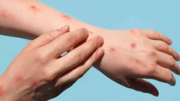  எப்படி பரவும்