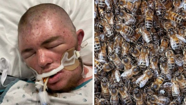 மோசமான பாதிப்பு