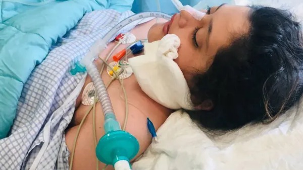 கோமா நிலைக்கு சென்று இறப்பு 