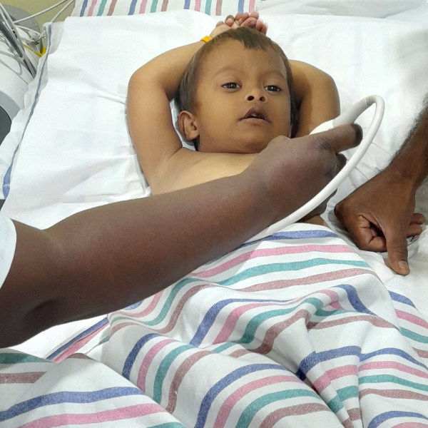 Congenital heart defect in 4-year-old boy in Krishnagiri: Please help if possible Congenital heart defect in 4-year-old boy in Krishnagiri: Please help if possible