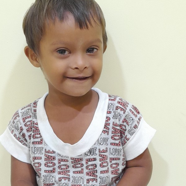 Congenital heart defect in 4-year-old boy in Krishnagiri: Please help if possible Congenital heart defect in 4-year-old boy in Krishnagiri: Please help if possible