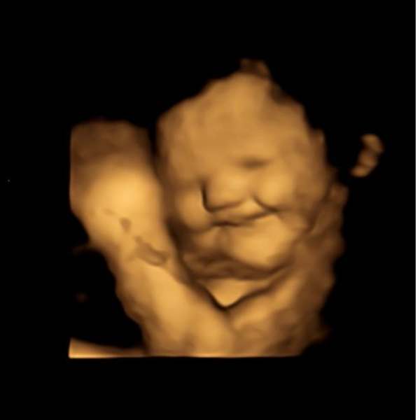 காய்கறியா ச்சீ ச்சீ.. 