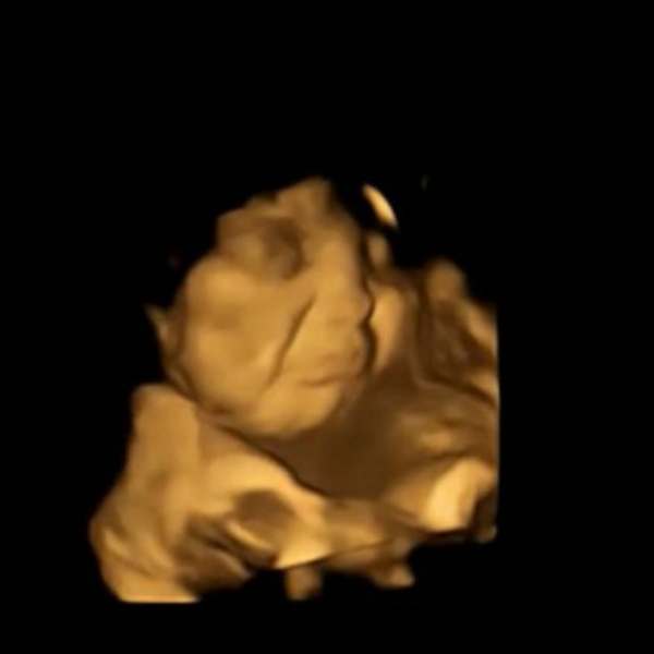 ஆராய்ச்சியில் இறங்கிய விஞ்ஞானிகள் 