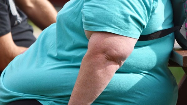 ஆபத்தை விளைவிக்கும் உடல் பருமன் 