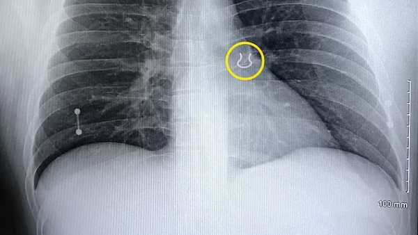 கேலி செய்கிறார் என நினைத்தேன் கேலி செய்கிறார் என நினைத்தேன்