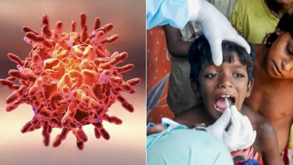 தொண்டை வலி 