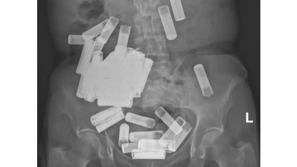 55 பேட்டரிகள் எடுக்கபட்டுள்ளது 