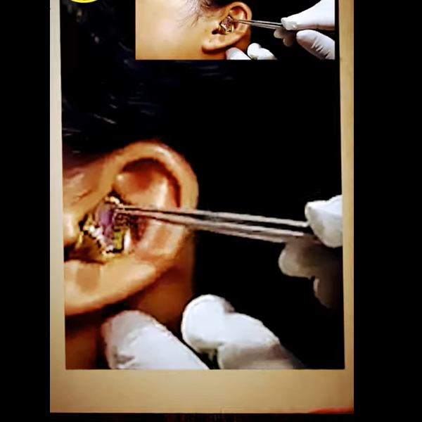  காதுக்குள் SNAKE