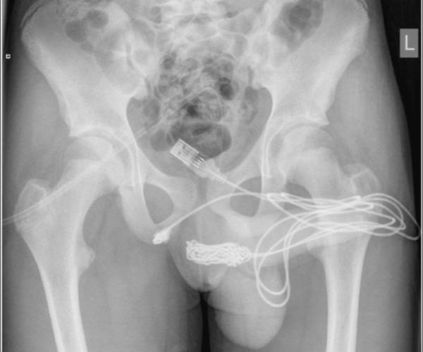 ஆண் குறி 