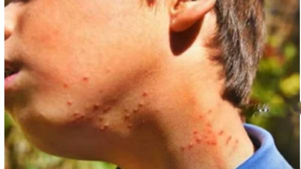 திருச்சியில் புதிய காய்ச்சல்.. 