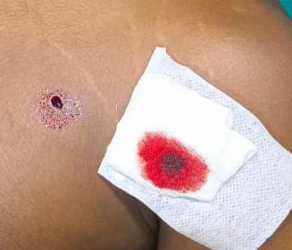 முழுமையான விசாரணை முழுமையான விசாரணை