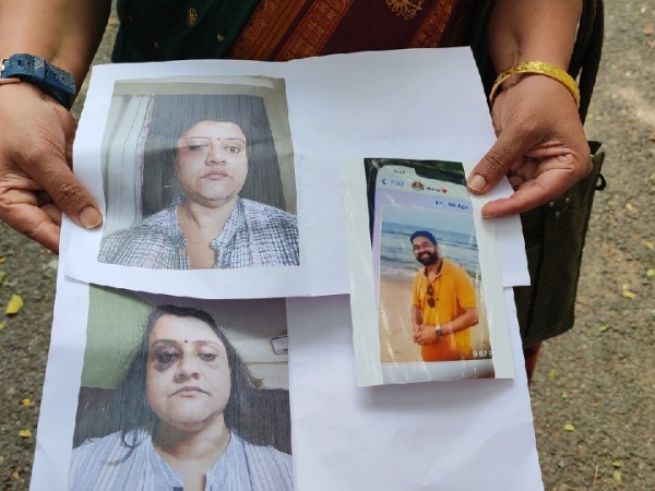 முகம் வீங்கிய நிலை