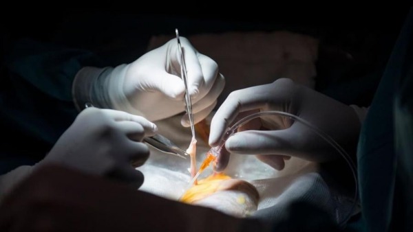 5 ஆண்டுகளாக வயிற்றுக்குள்.. 