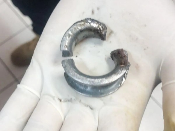 உலோக வளையம் உலோக வளையம்