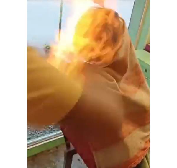 தீப்பிடித்து எரிந்த தலை 