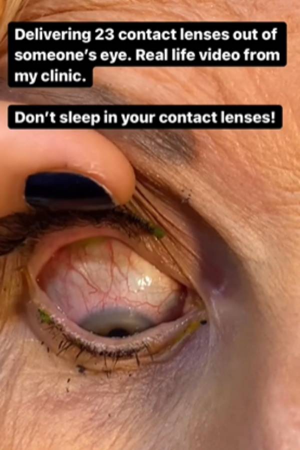 பரவும் வீடியோ பரவும் வீடியோ