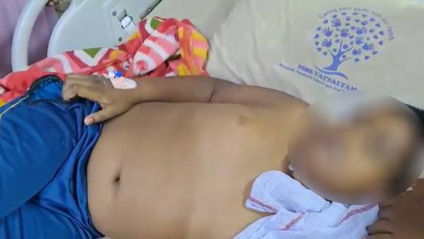 சிறுவனுக்கு குறையாத காய்ச்சல் 