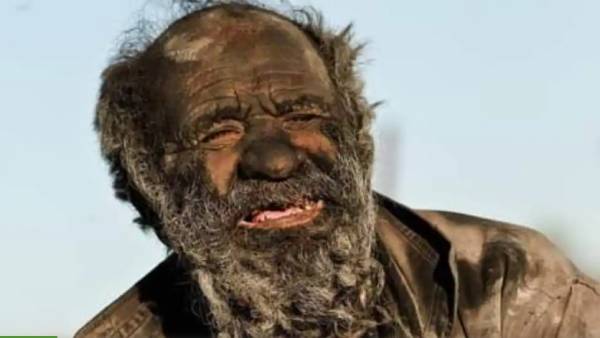 அழுக்கு மனிதர் மரணம் 