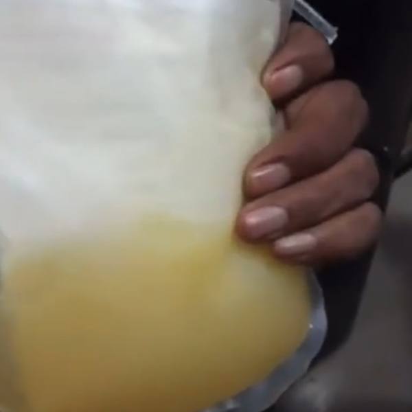 ரத்த தட்டணுக்கள் 