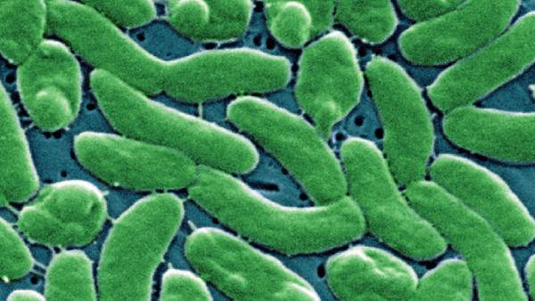 ஸ்கேனை பார்த்து அதிர்ந்த மருத்துவர்கள் 