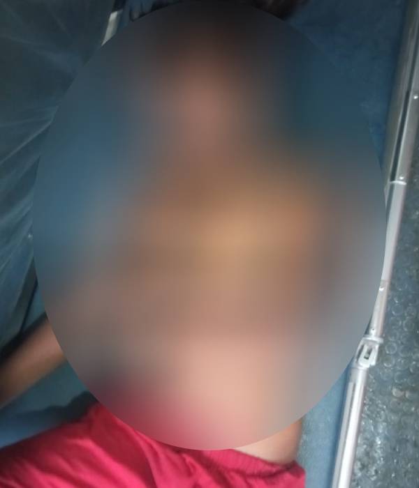 பிரேத பரிசோதனை பிரேத பரிசோதனை