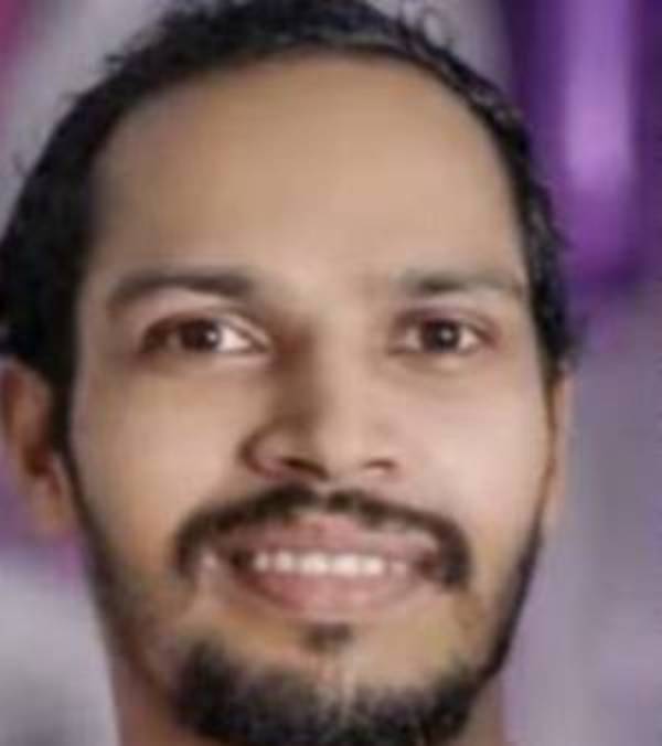 முடி கொட்டியது 