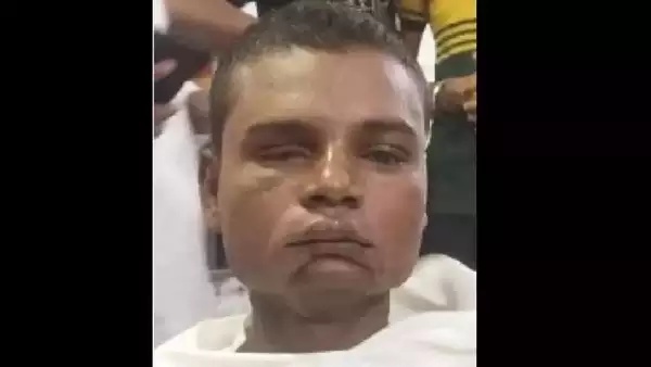 பார்வை பறிப்பு