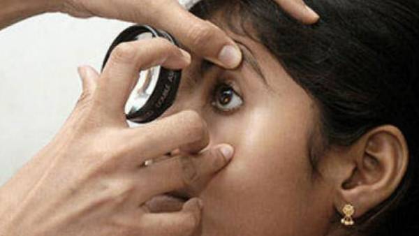 மெட்ராஸ் ஐ 