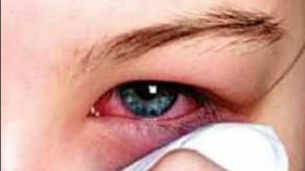  ஒவ்வாமை 