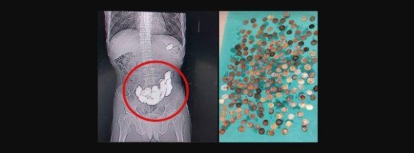 187 நாணயங்கள்