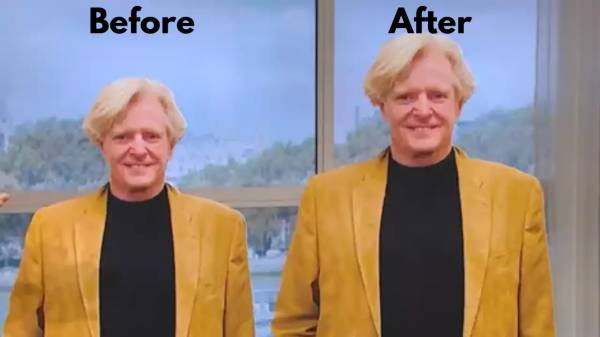 அறுவை சிகிச்சை மூலம் அறுவை சிகிச்சை மூலம்