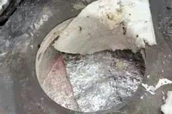  தீக்காயங்கள் உருகிய அலுமினியத்தால்தான் 