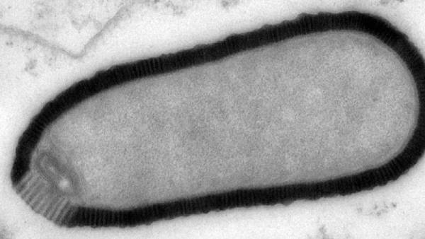  ஜாம்பி வைரஸ்