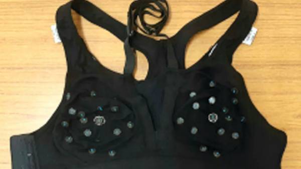 எம்ஆர்ஐ ஸ்கேன் 