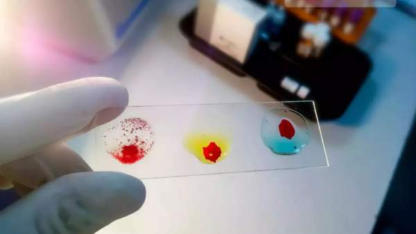 1-3 வரை விழிப்பு வருகிறதா 1-3 வரை விழிப்பு வருகிறதா