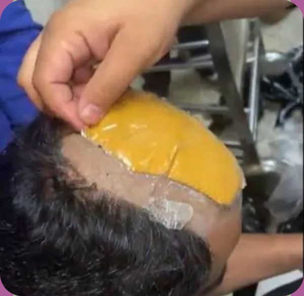 விக் விக் விக்