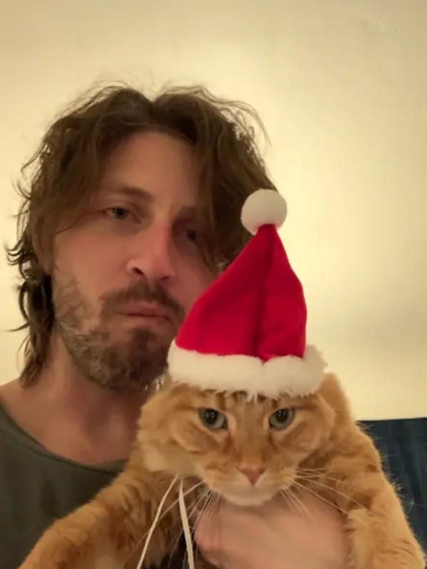 தவறுதலாக இந்த எக்ஸ்ரேவை