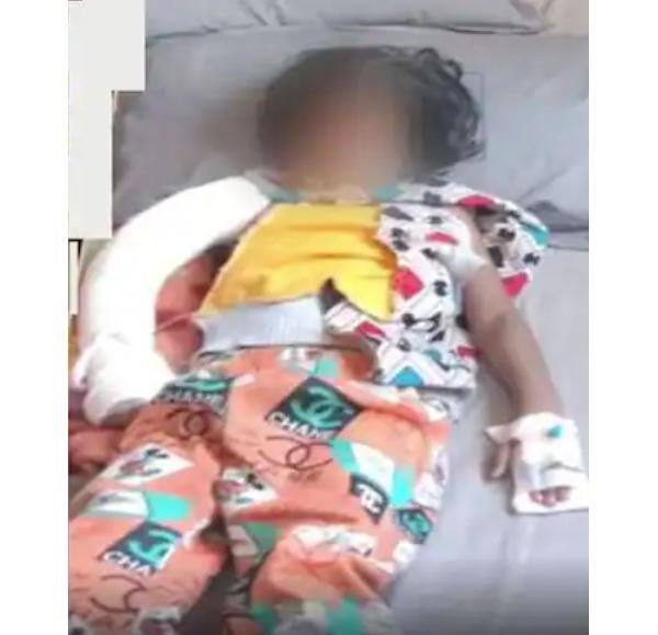 கையை உடைத்த ஆசிரியர் 