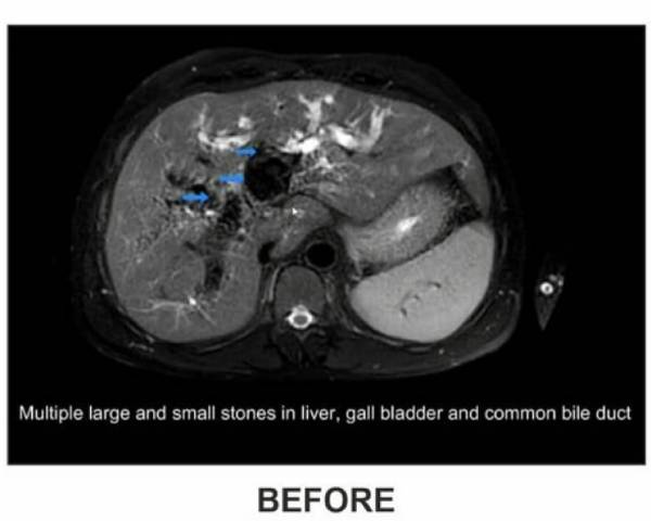 ஐந்து நாட்கள் அறுவை சிகிச்சை ஐந்து நாட்கள் அறுவை சிகிச்சை