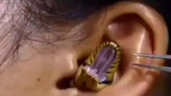  காதுக்குள்ளே பாம்பு 