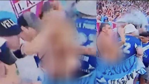 முழங்கால் டிரஸ் முழங்கால் டிரஸ்