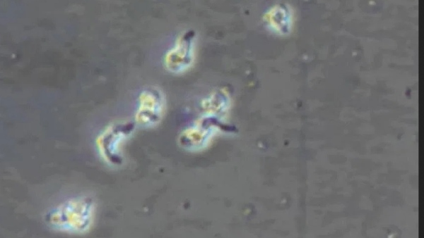  தவிர்க்க வேண்டும்