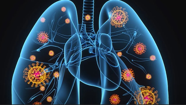  தீவிர பாதிப்பு