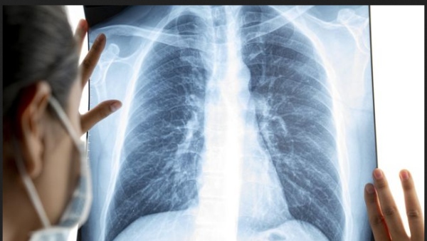  தடுப்பாற்றல் குறைவு