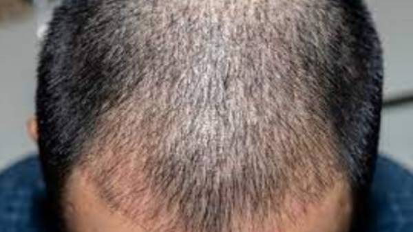 விளம்பரம் 