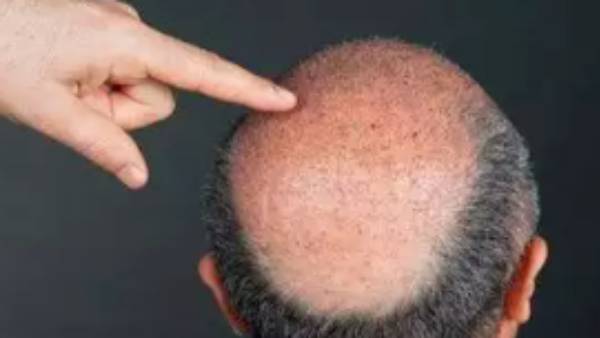 பரிசோதனை 