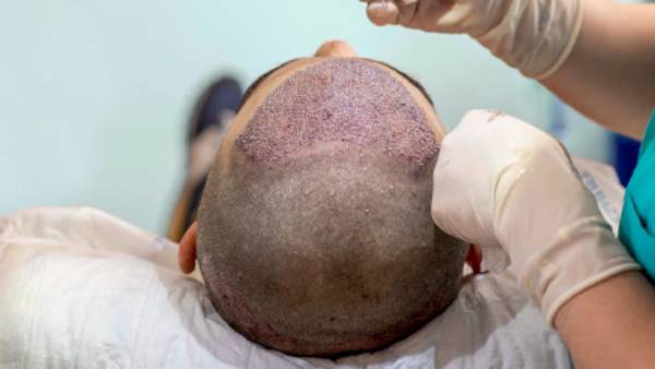  அறுவை சிகிச்சை 