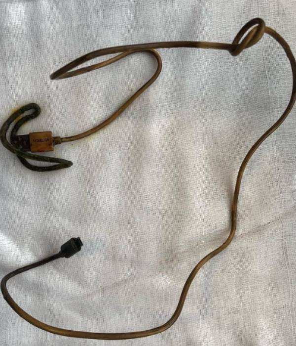 எப்படி வயிற்றுக்குள் சென்றது 